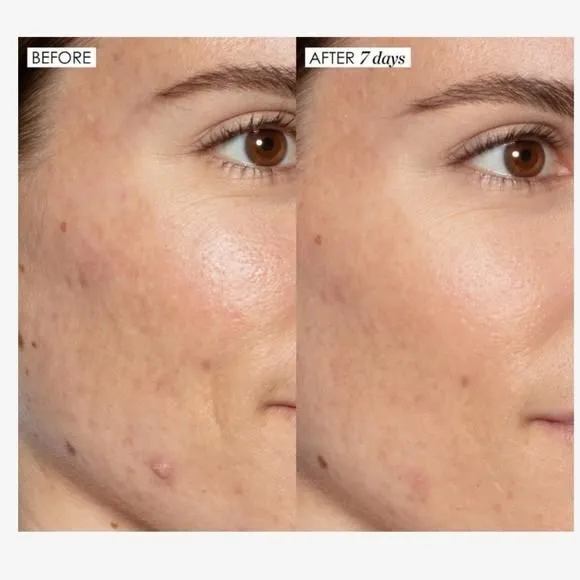 Product image for 🖤 Good genes all in one lactic acid treatment .17 fl oz